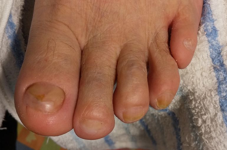 爪お手入れ後